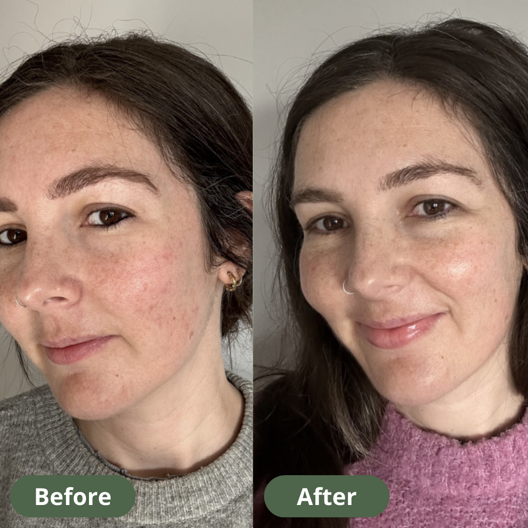 Skin Hydration Cream