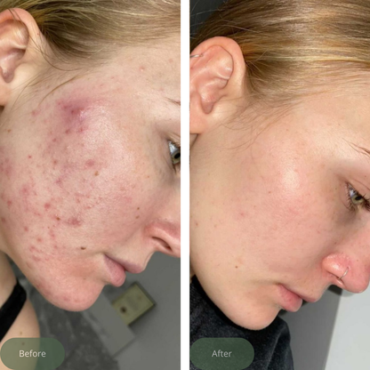 Charcoal Facial Cleanser