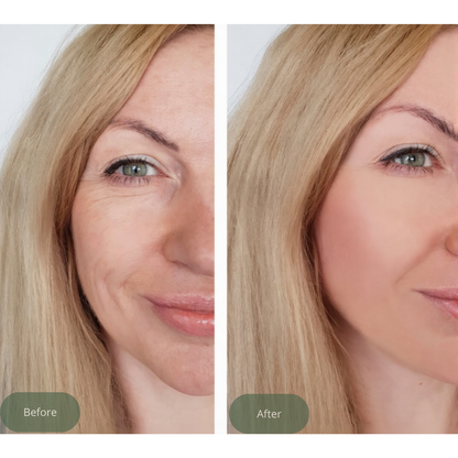 Skin Hydration Cream