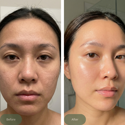 Aloe & Tea Tree Radiance Gel